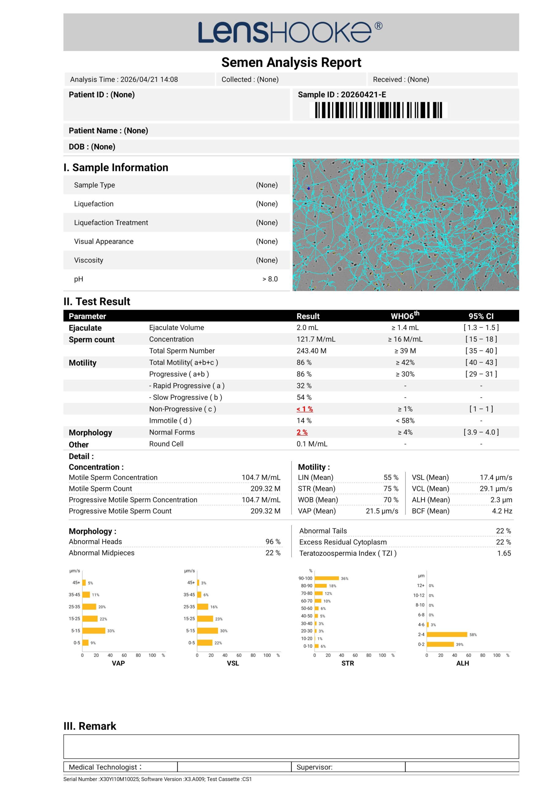 Sample semen analysis report. Personal information has been removed.
